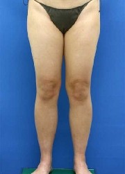 佐々木さんの２ヶ月前